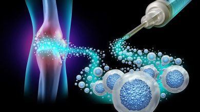 راه جدید دانشمندان برای درمان آرتروز