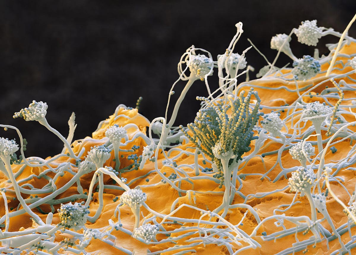 سد دفاعی دمای بدن ۳۷ درجه؛ تنها دلیلی که ما هنوز خوراک قارچها نشدهایم