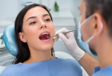 علت سفید شدن لثه بعد از جراحی دندان چیست؟ طبیعی یا نشانه خطر!