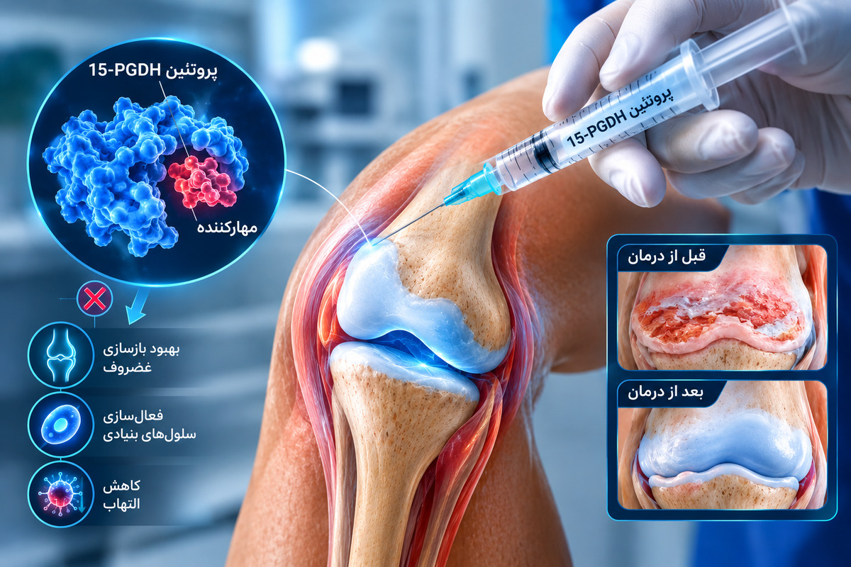 پروتئین 15-PGDH چگونه به هدف دانشمندان تبدیل شد؟
